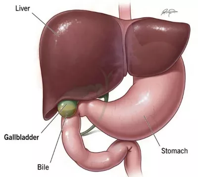 Best laparoscopic surgeon in Patna, laparoscopic gallbladder surgery, laser operation for gall bladder stone, piles doctor in Patna, laser surgery for piles, laser surgery for fissure, laser fistula surgery, laparoscopic appendix surgery, Hernia Surgery in Patna, Best Hernia Surgery in Patna, Laparoscopic Hernia, Surgery in Patna, laparoscopic gallbladder surgery in Patna, laser operation for gall bladder stone in Patna, laser surgery for piles in patna, best laparoscopic surgeon in patna, best piles doctor in patna, hernia surgeon in patna, hernia specialist in patna, hernia center in patna, hernia operation in patna, gallbladder stone surgery in patna, gall bladder stone operation in patna, fistula doctor in patna, top laparoscopic surgeon in patna, general surgeon in patna, fistula laser treatment cost in patna, laser surgery for fissure in patna, Laser surgery for Prostate, Laser surgery for Kidney stone, Laser surgery for stone in ureter, Laser surgery for stone in urinary bladder, Best kidney stone surgeon in Patna , Best Prostate surgeon in Patna, Best Urologist in Patna, Best Urethral stricture surgeon in Patna, Best Urinary Bladder stone surgeon in Patna, Piles surgeon in Patna, bawasir surgeon in patna, bawasir doctor in patna. bawasir specialist doctor in patna, bawasir specialist in patna, laser fistula surgery in patna, laparoscopic appendix surgery in Patna